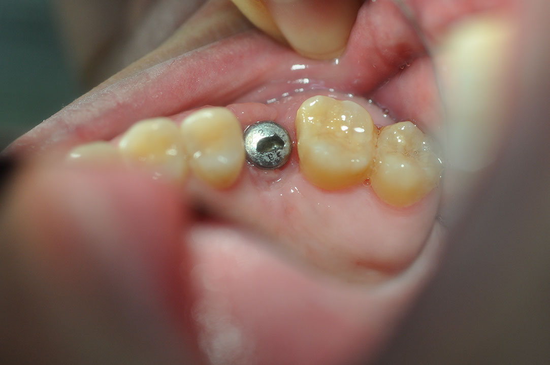 %_tempFileNameImplant%20108c2%