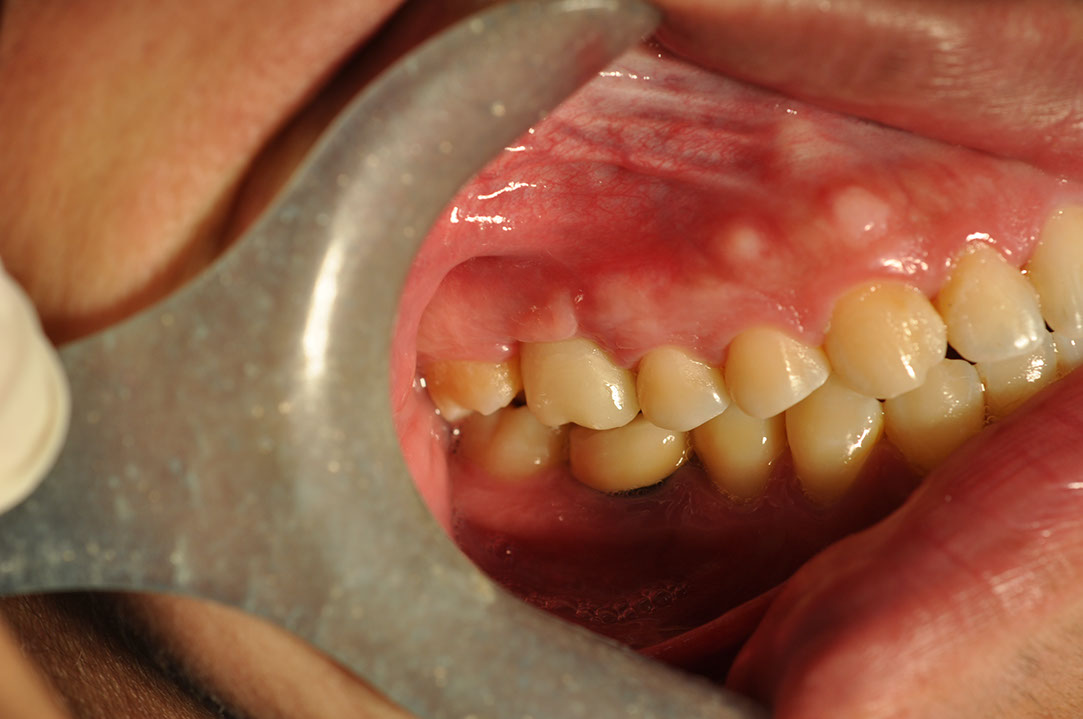 %_tempFileNameImplant%20108c6%