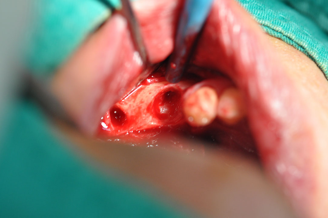 %_tempFileNameImplant%20109a6%