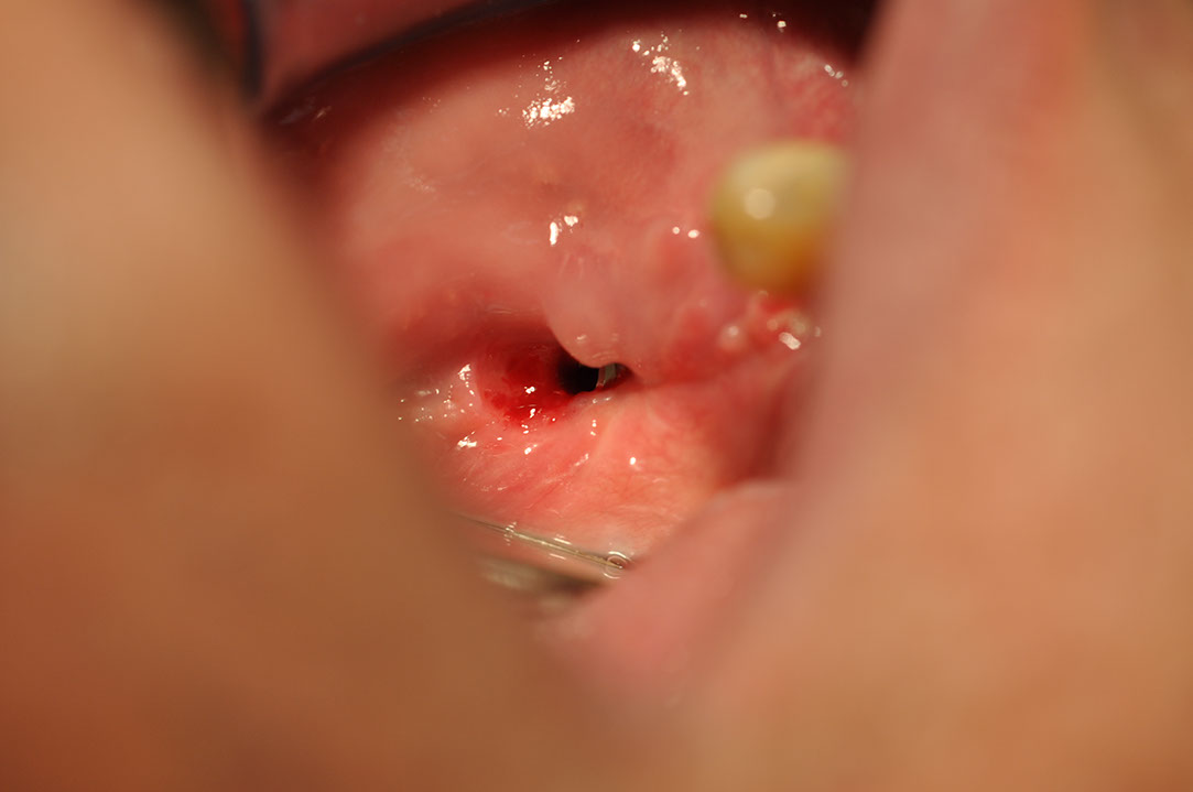 %_tempFileNameImplant%20109e1%