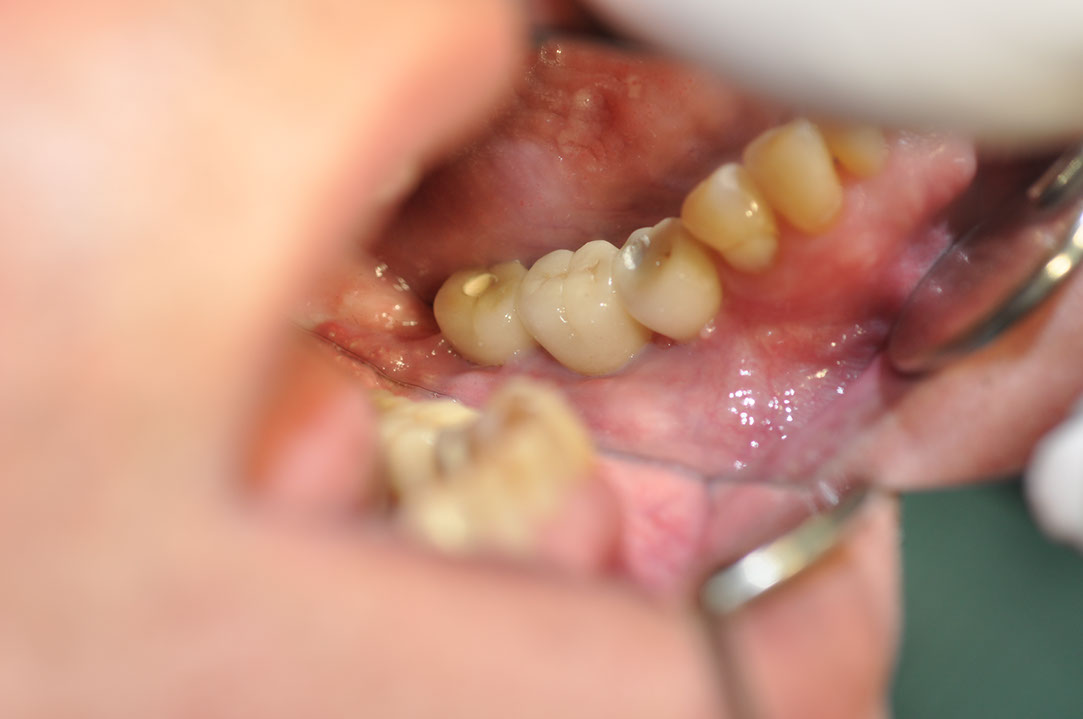 %_tempFileNameImplant%20109e4%