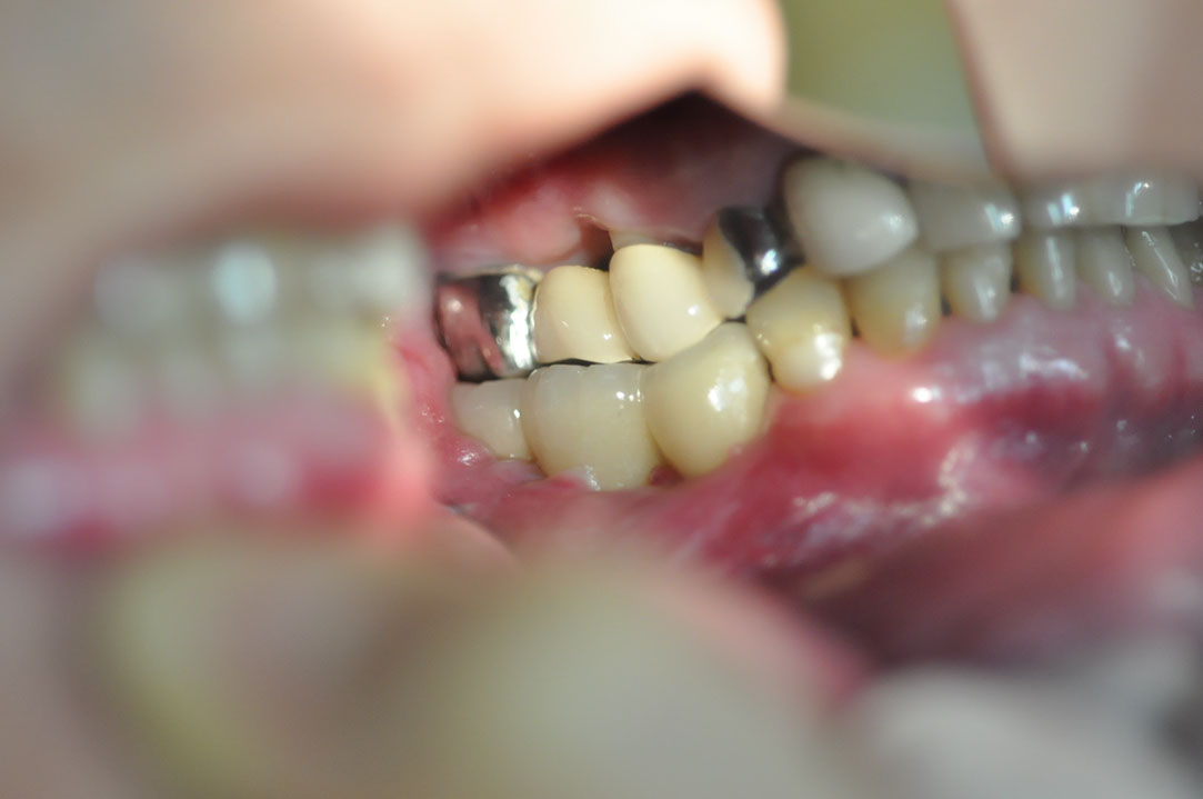 %_tempFileNameImplant%20109e5%