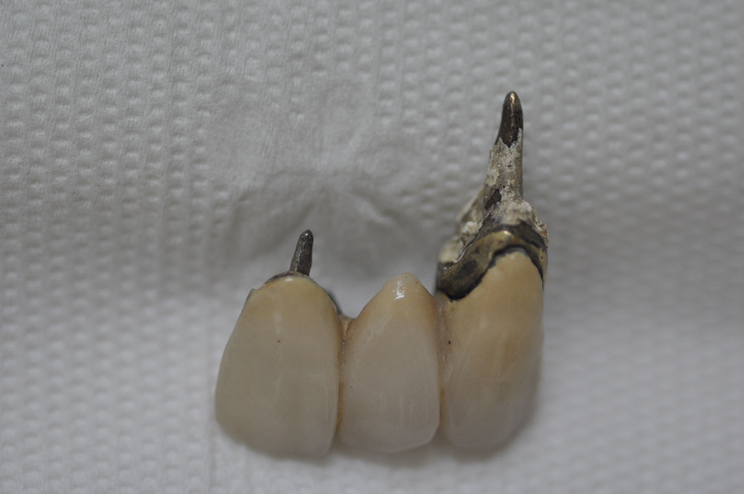 %_tempFileNameImplant%20110a2%