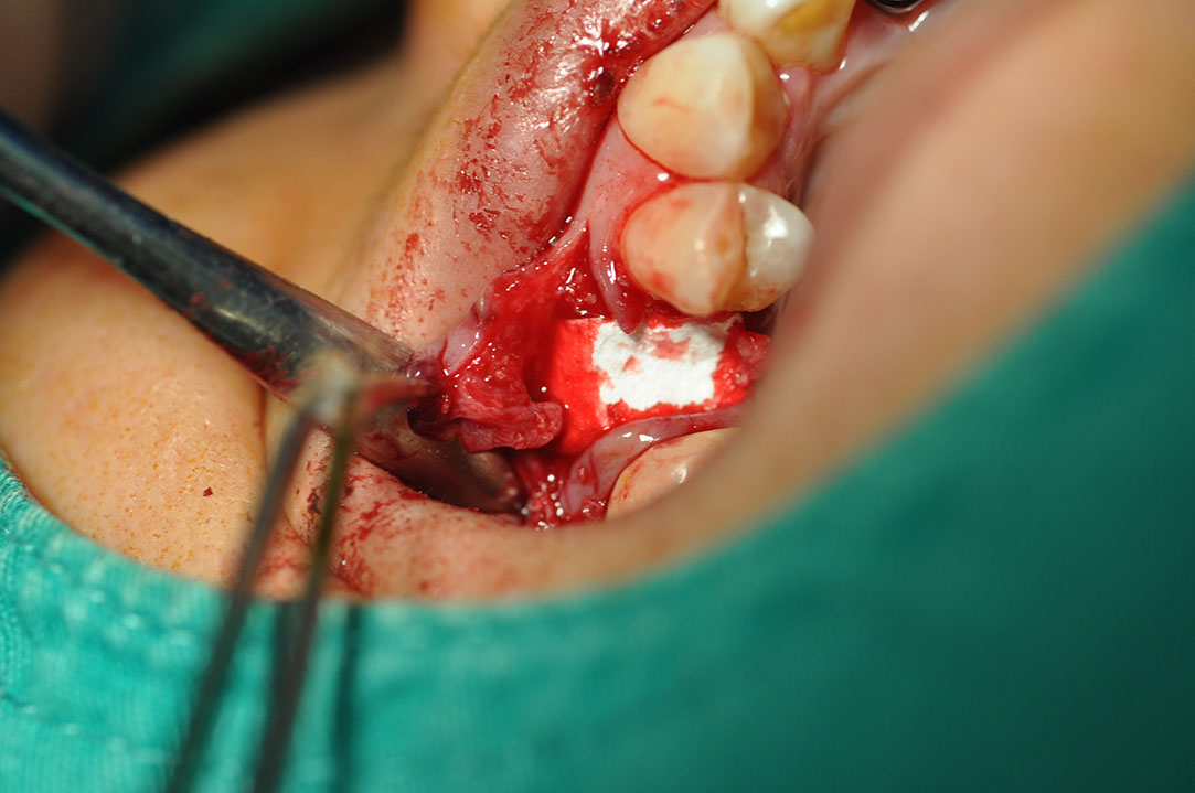 %_tempFileNameImplant%20113c2%
