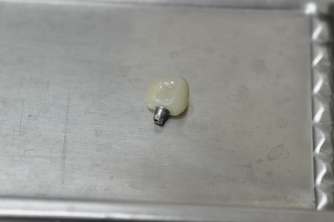 %_tempFileNameImplant%20113d2%