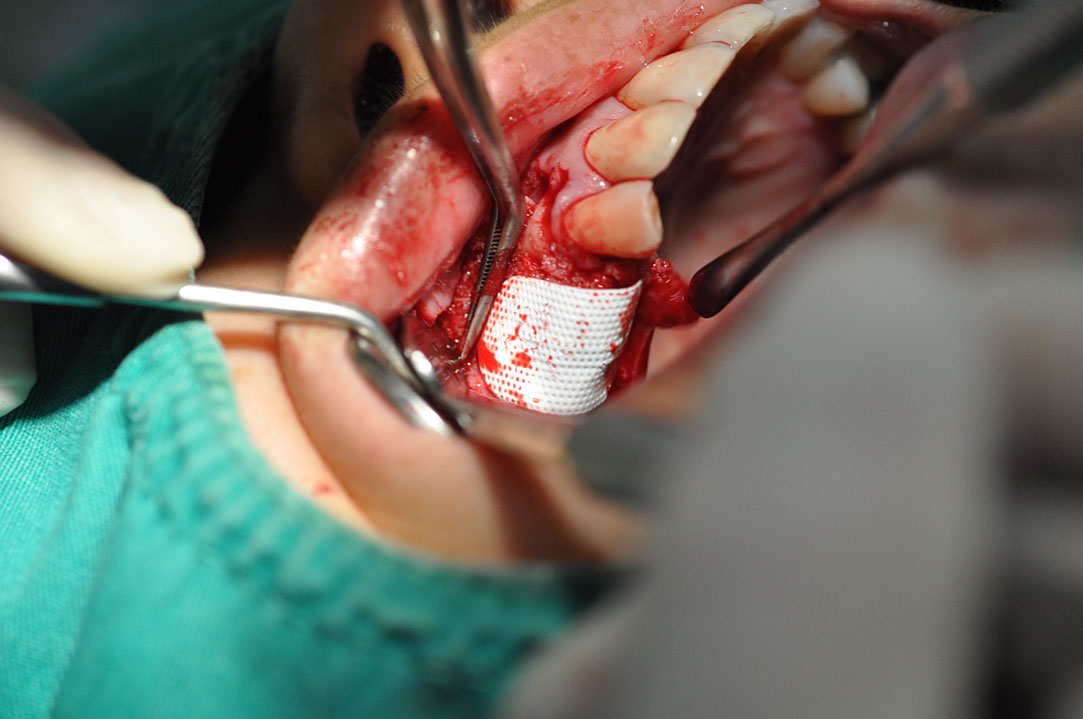 %_tempFileNameImplant%20115Eb6%