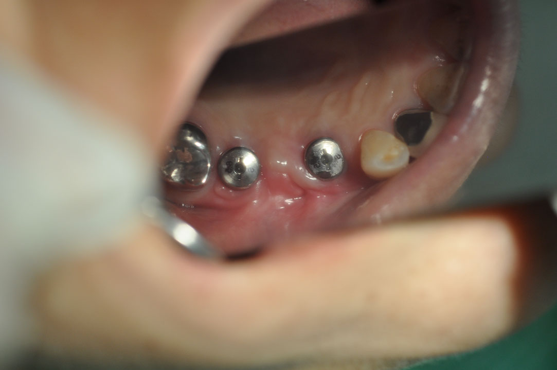 %_tempFileNameImplant%20115Ec8%