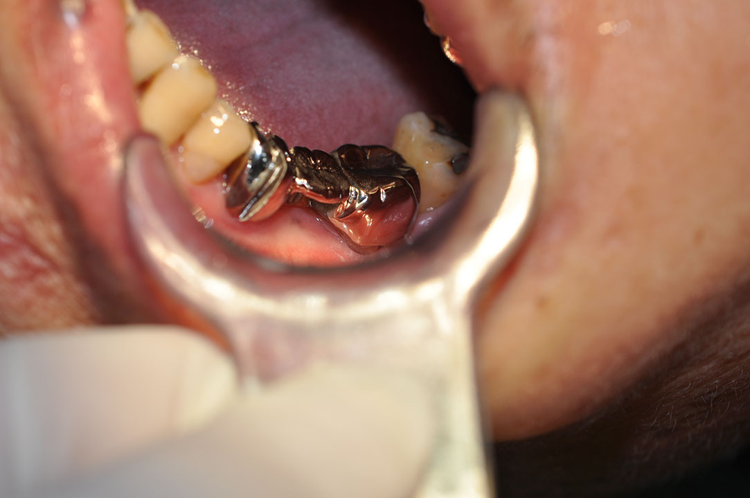 %_tempFileNameImplant%20116a1%