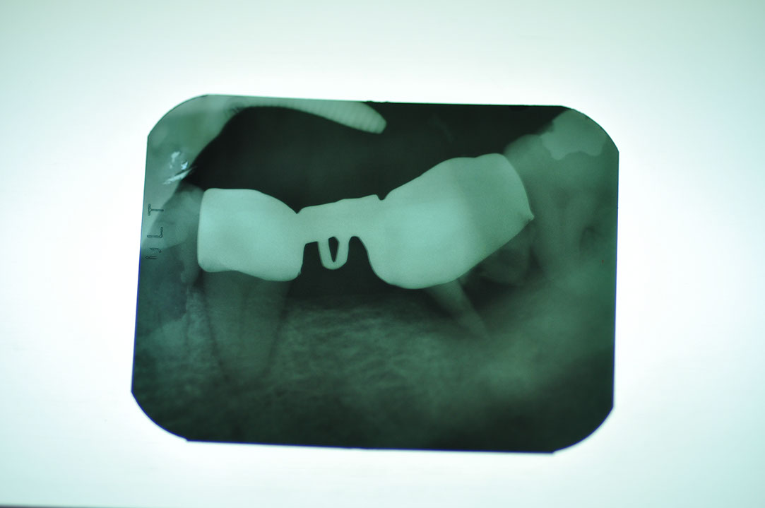 %_tempFileNameImplant%20116a2%