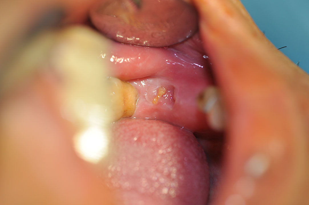 %_tempFileNameImplant%20116a3%