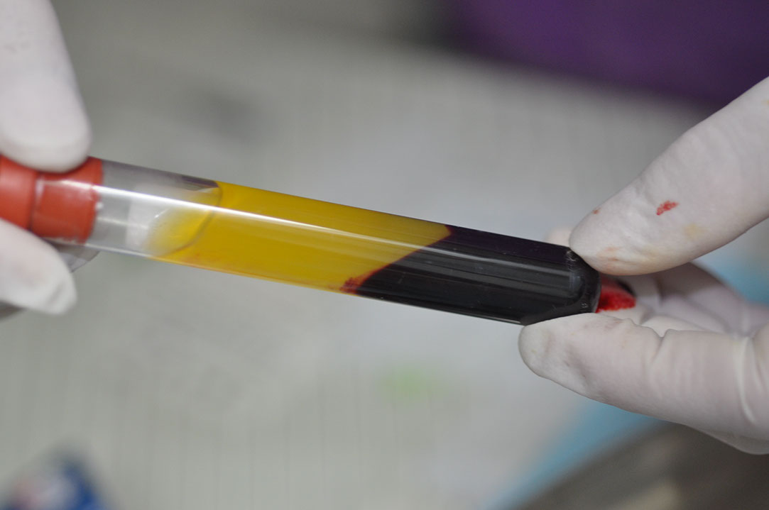 %_tempFileNameImplant%20116a5%