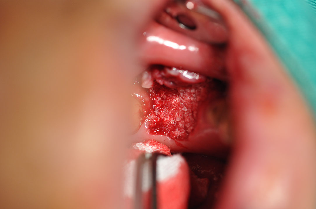 %_tempFileNameImplant%20116a7%