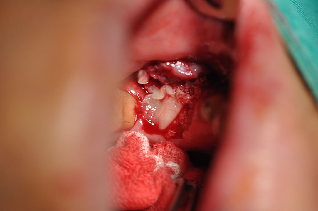 %_tempFileNameImplant%20116a8%