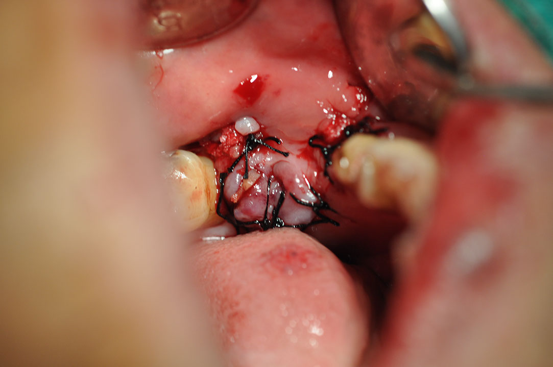 %_tempFileNameImplant%20116a9%