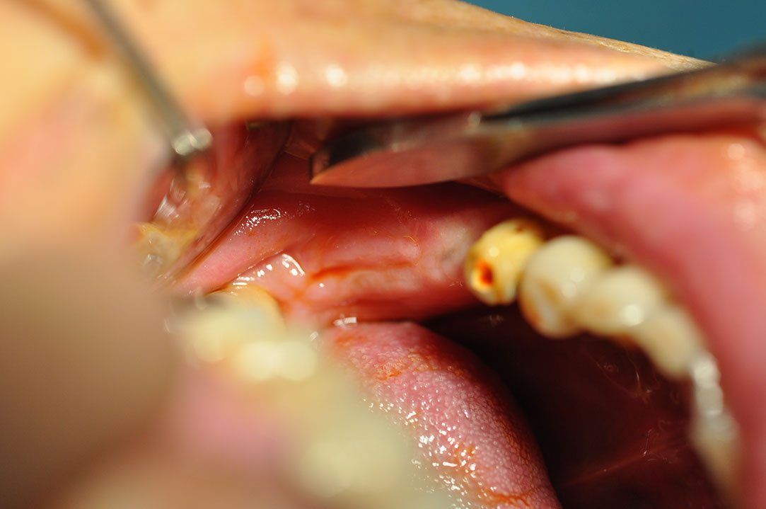 %_tempFileNameImplant%20116b1%