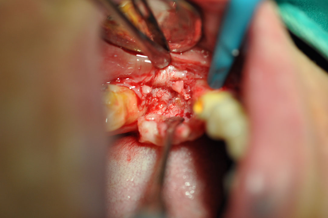 %_tempFileNameImplant%20116b2%