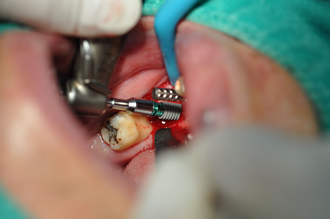 %_tempFileNameImplant%20116b3%