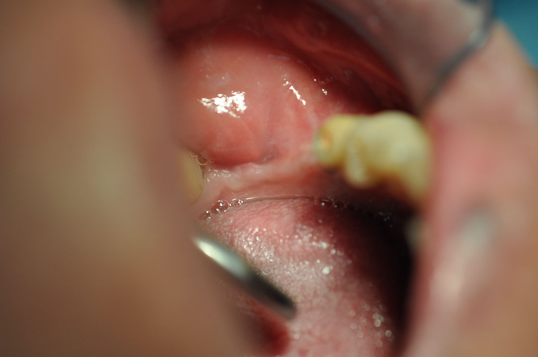 %_tempFileNameImplant%20116b4%