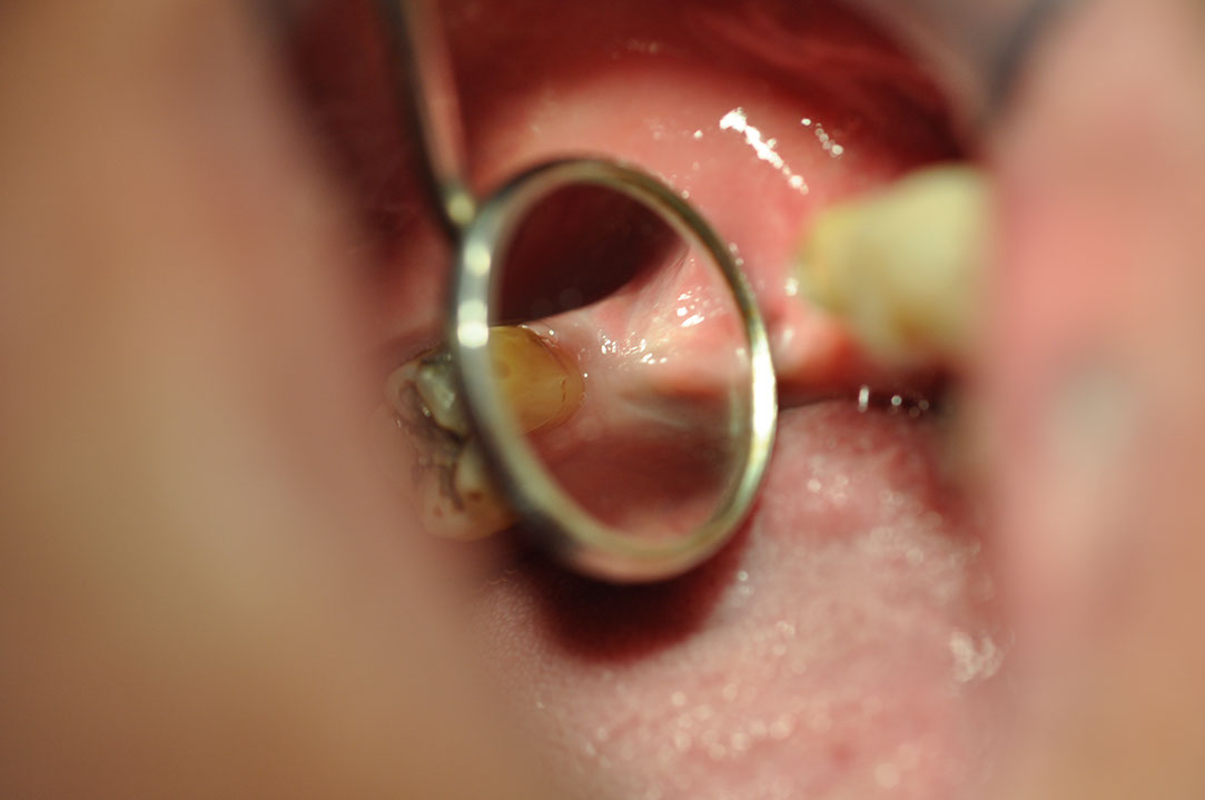 %_tempFileNameImplant%20116b5%