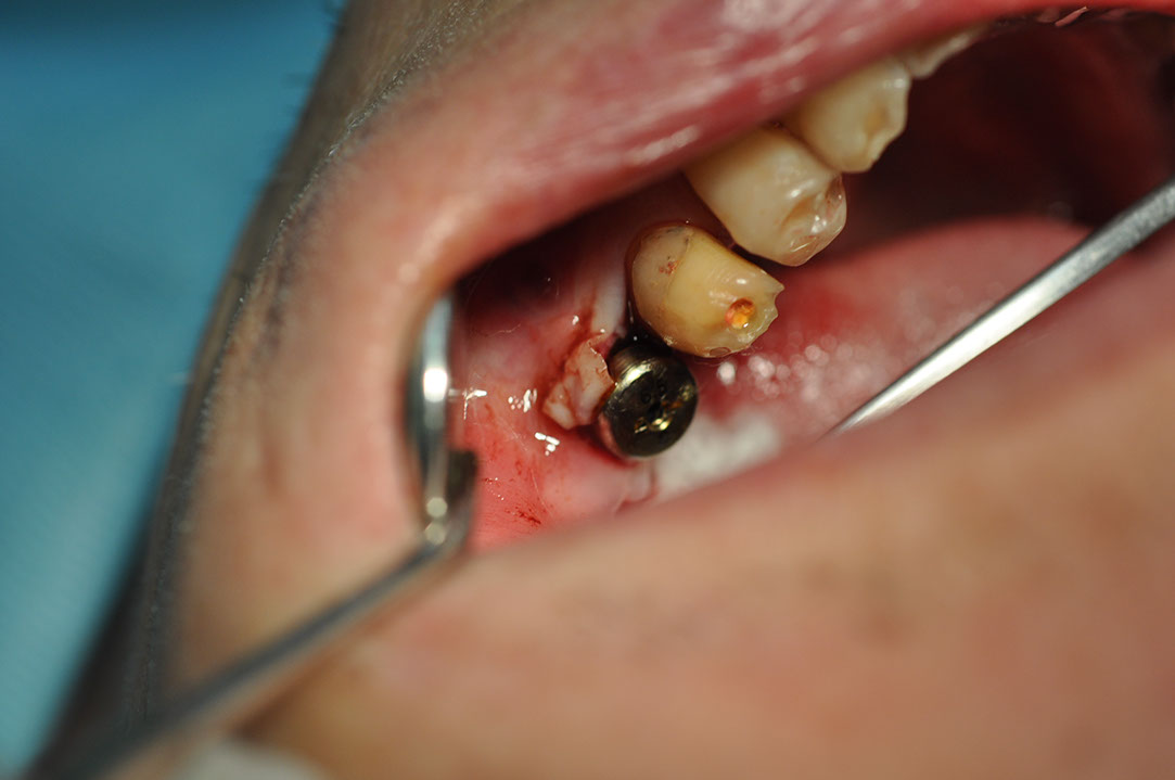 %_tempFileNameImplant%20116b6%