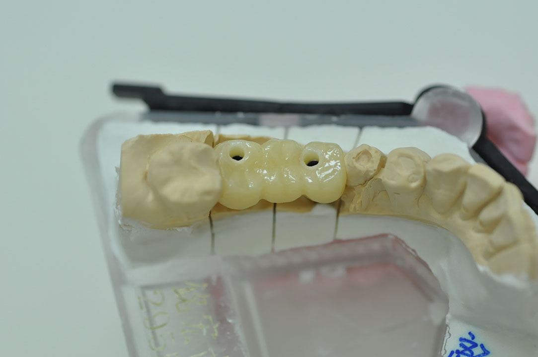 %_tempFileNameImplant%20116c1%