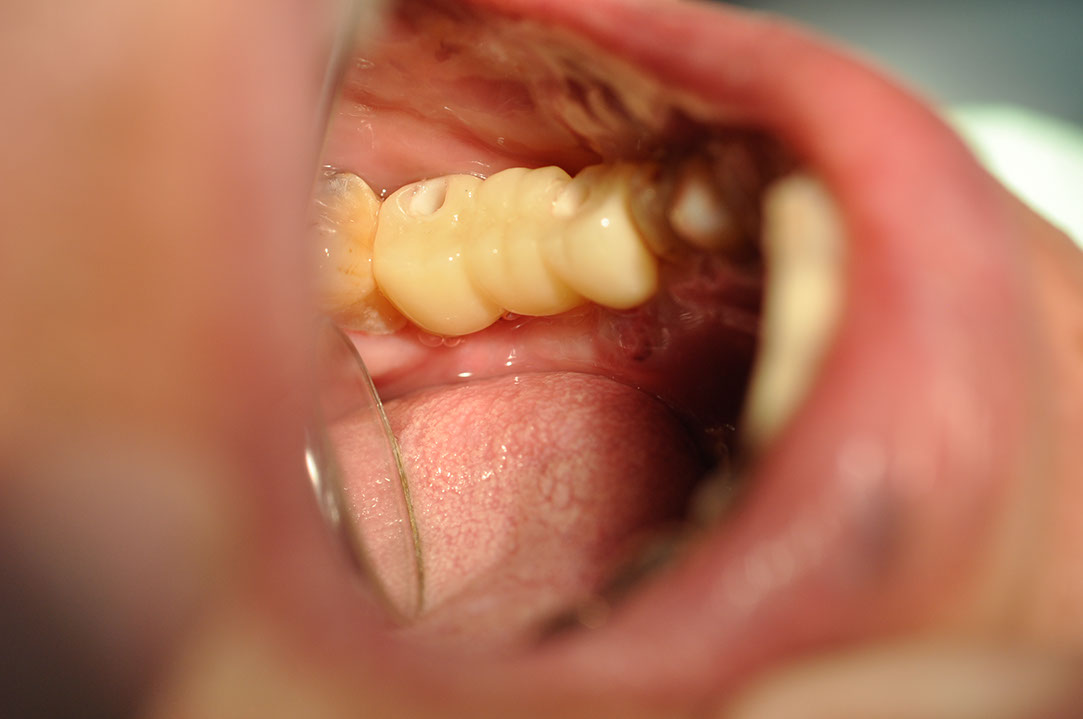 %_tempFileNameImplant%20116c2%