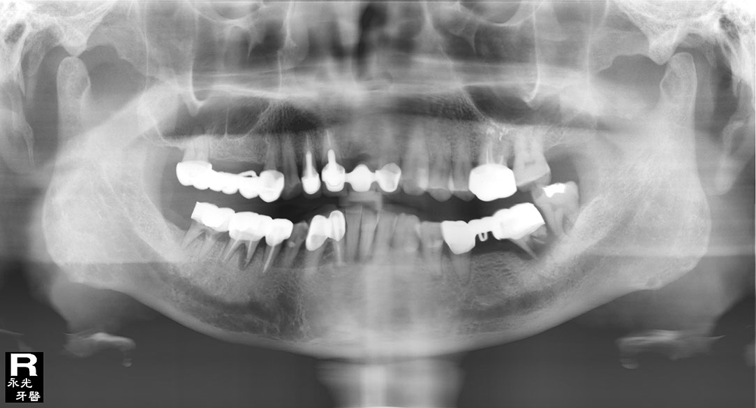 %_tempFileNameImplant%20116d1%