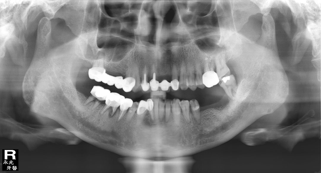 %_tempFileNameImplant%20116d2%