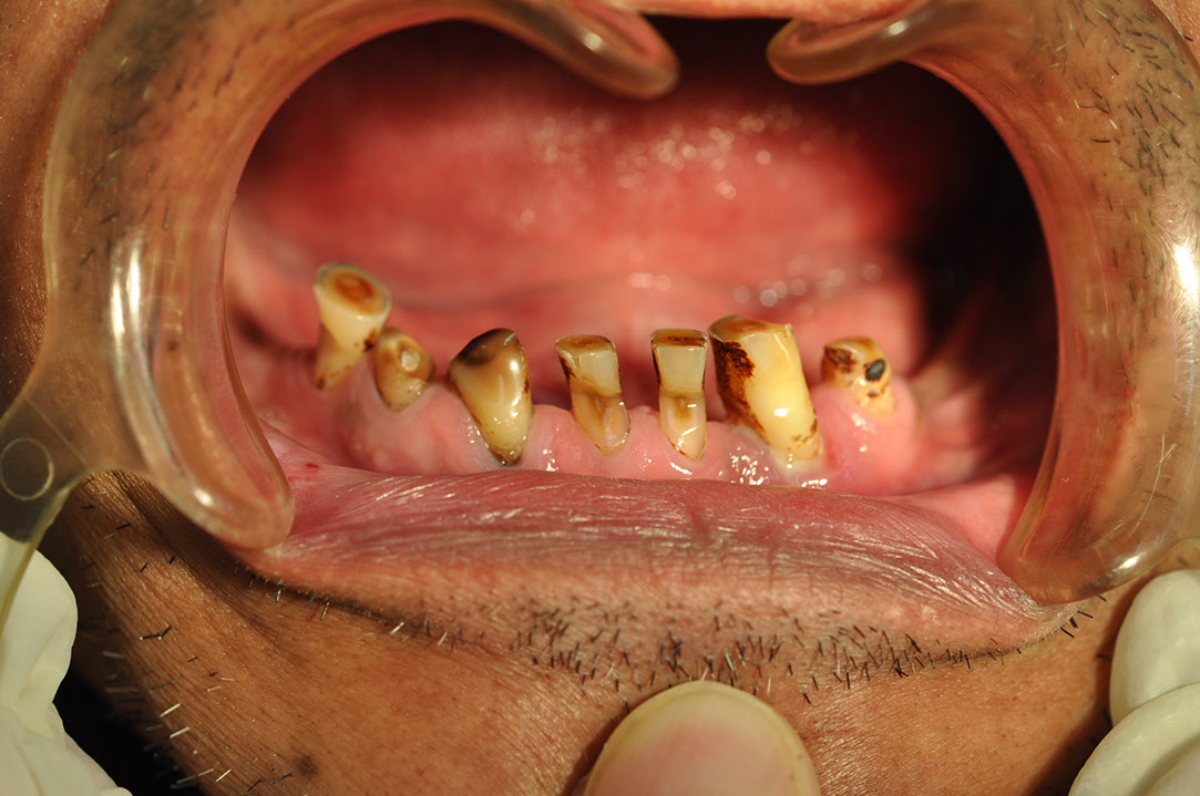 %_tempFileNameImplant%20118a3%