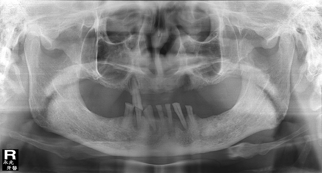 %_tempFileNameImplant%20118a4%