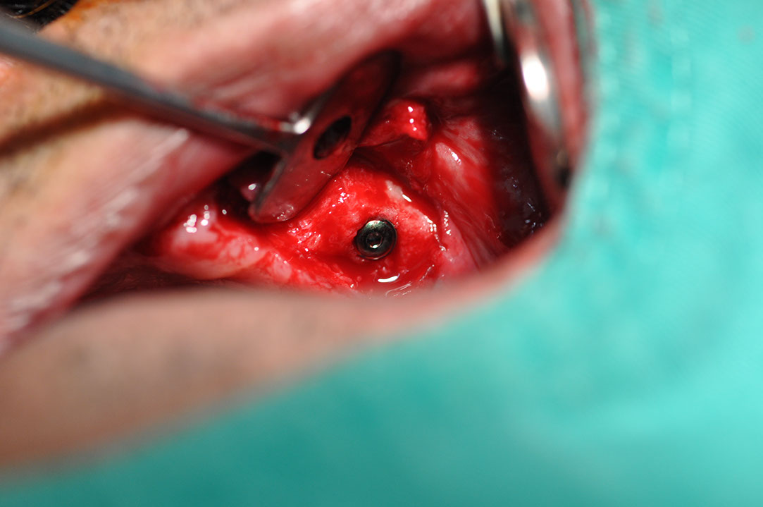 %_tempFileNameImplant%20118a6%