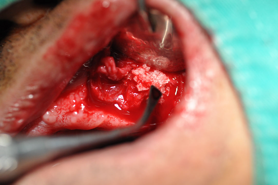 %_tempFileNameImplant%20118a9%