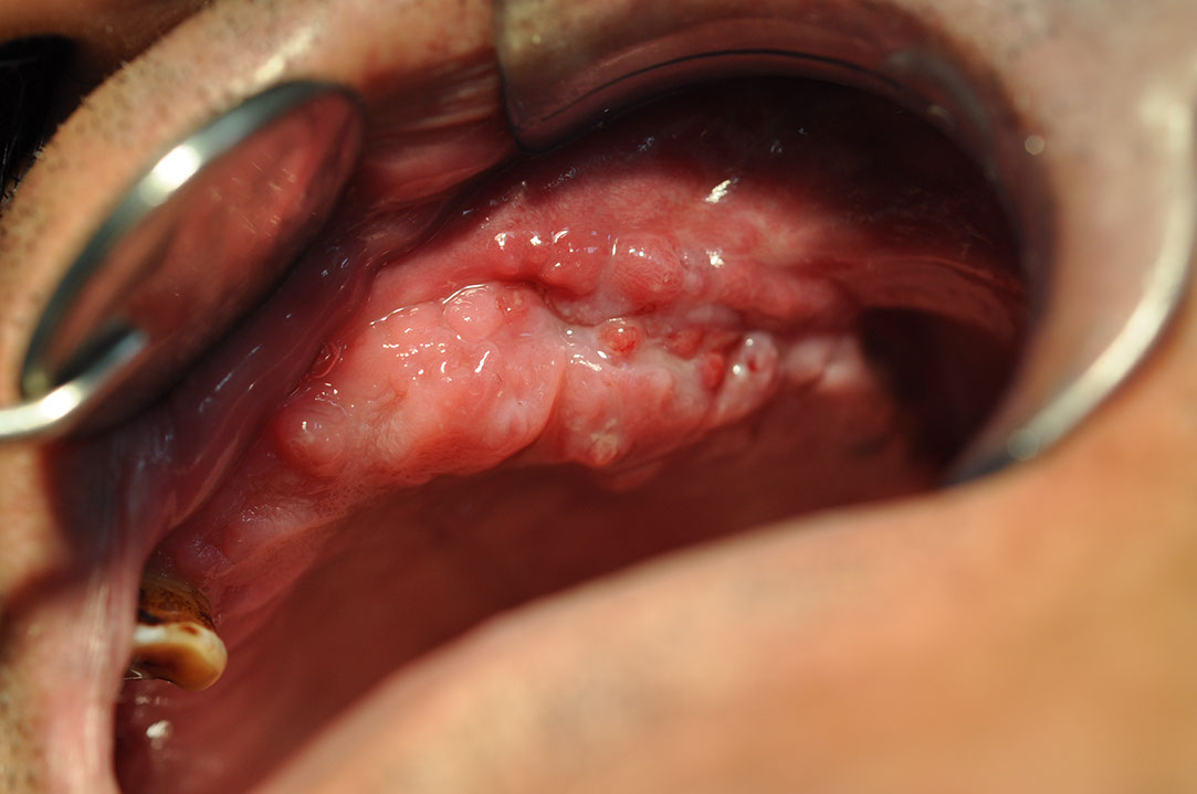 %_tempFileNameImplant%20118b3%