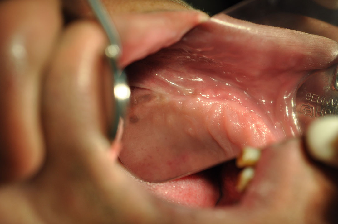 %_tempFileNameImplant%20118b4%