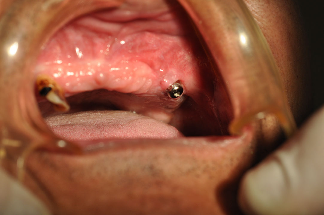 %_tempFileNameImplant%20118b5%