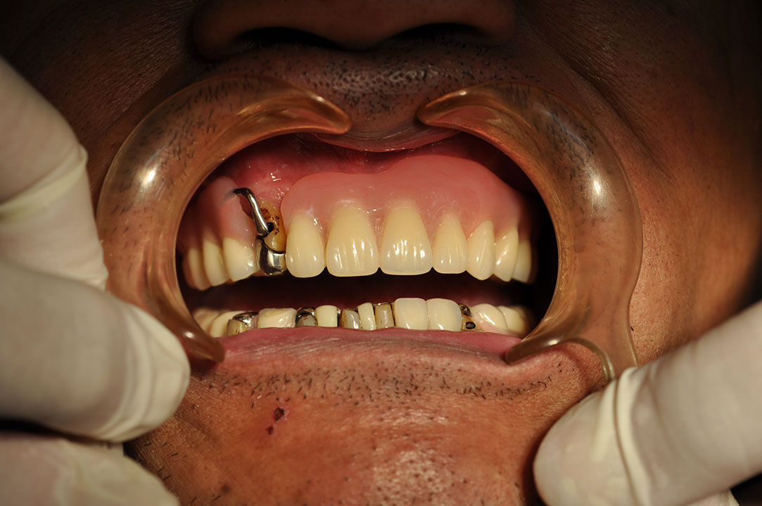 %_tempFileNameImplant%20118c2%