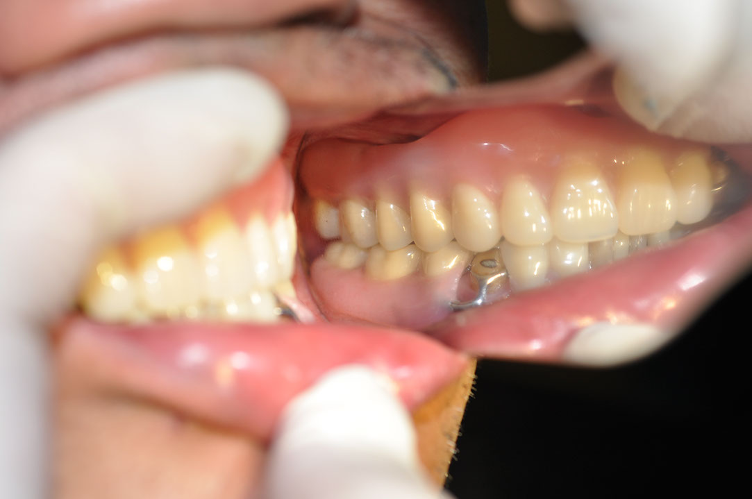 %_tempFileNameImplant%20118c3%