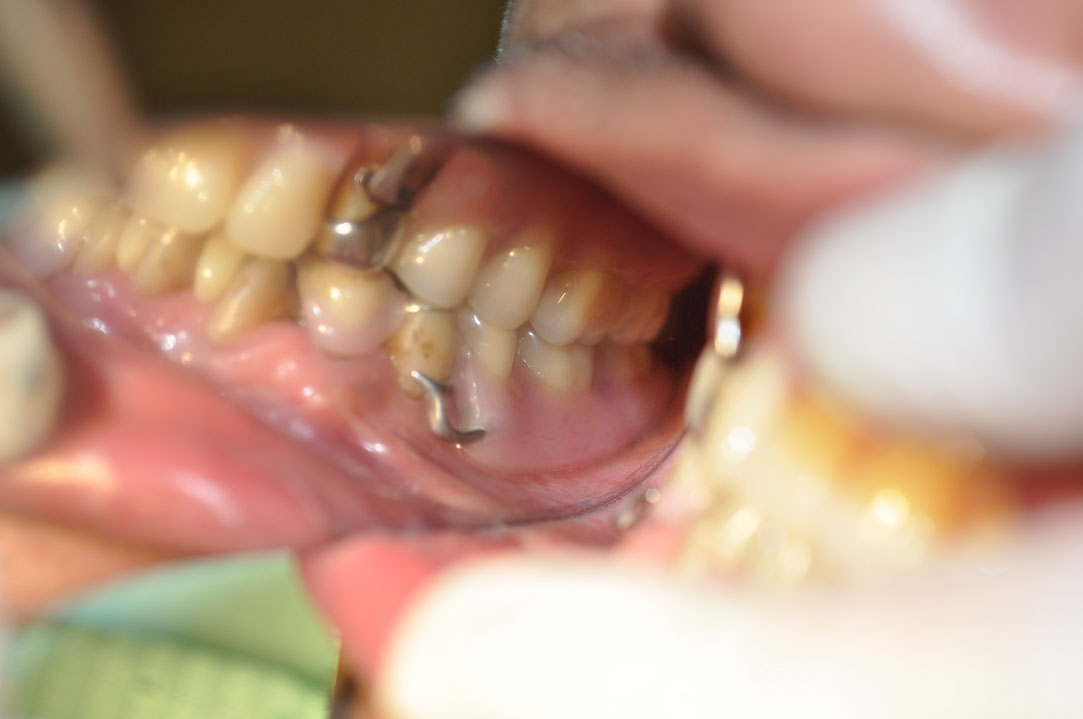 %_tempFileNameImplant%20118c4%