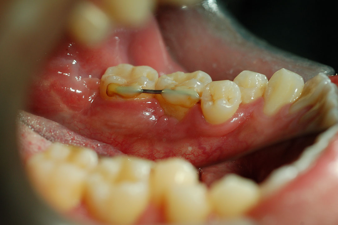%_tempFileNameImplant%2011d1%