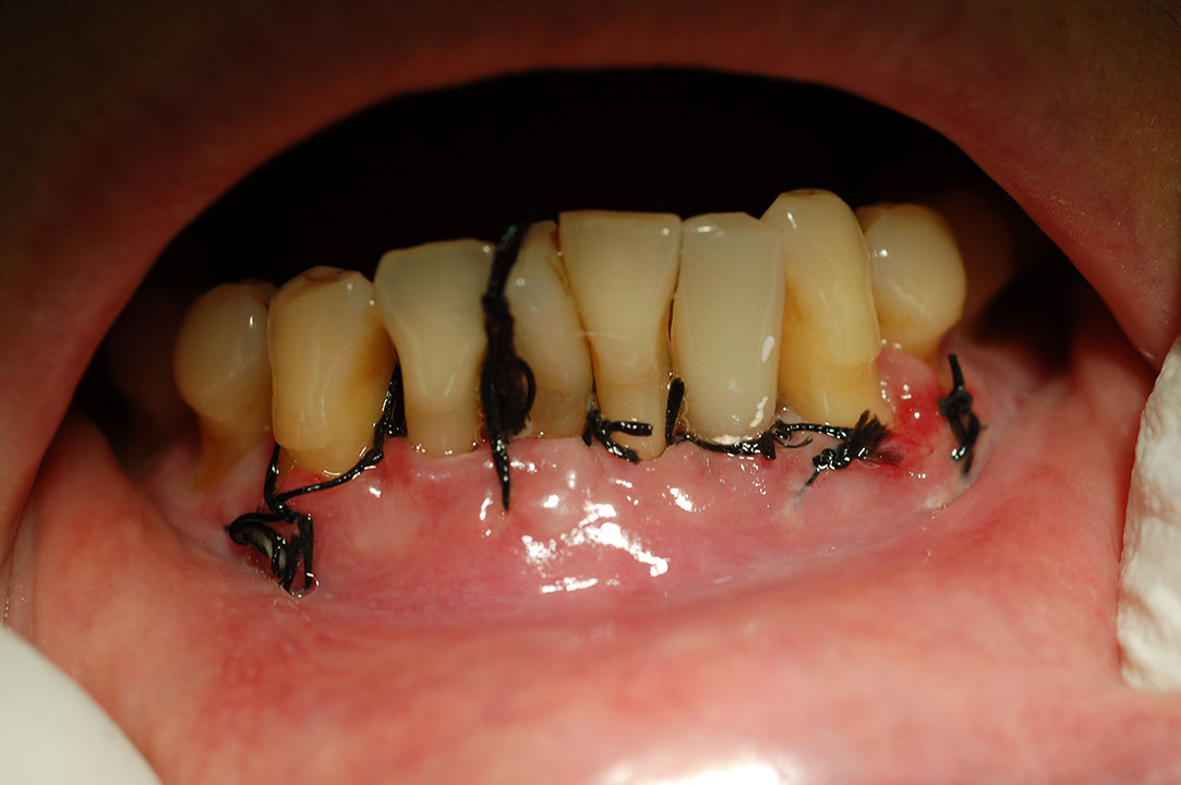 %_tempFileNameImplant%2012d1%
