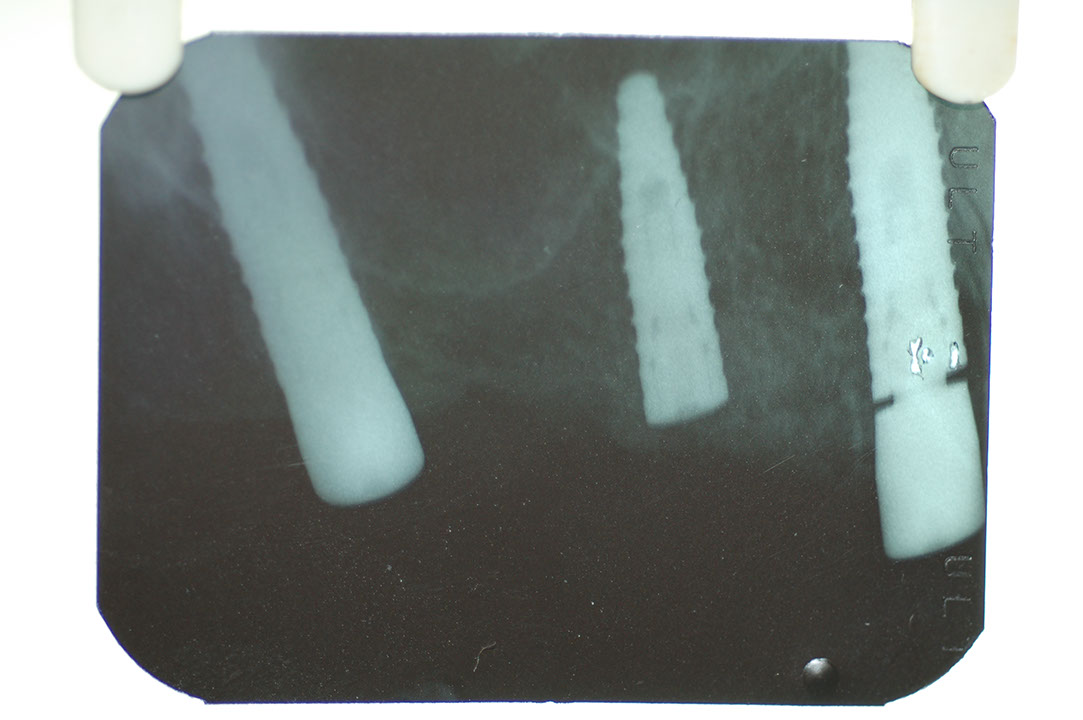 %_tempFileNameImplant%2015a2-4%