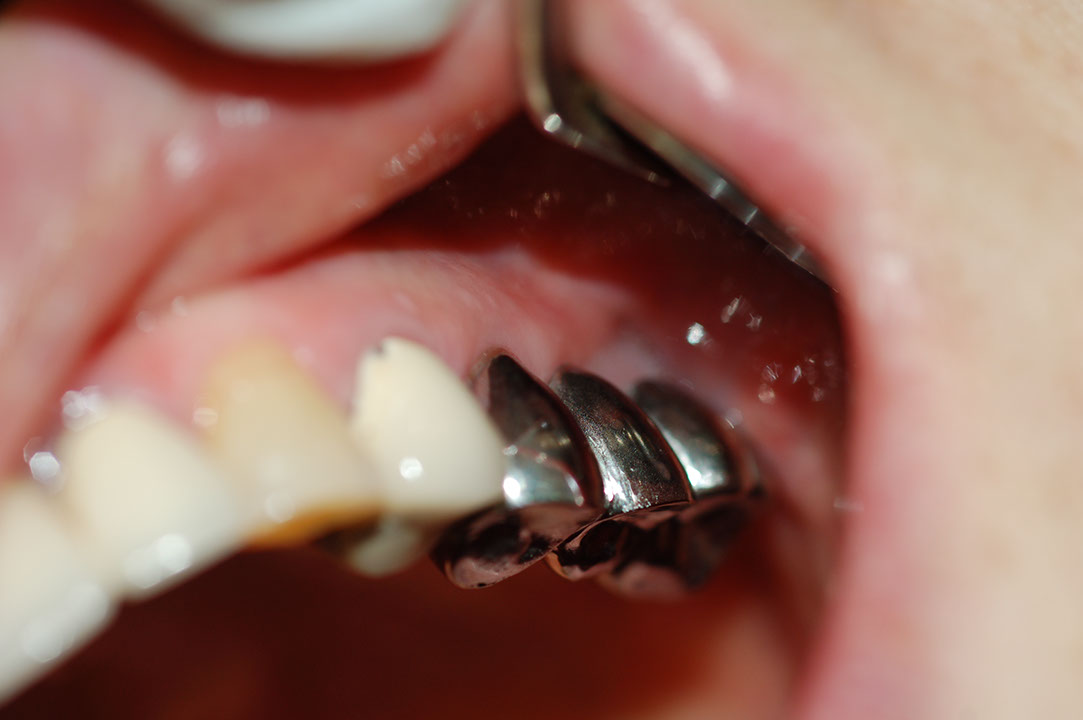 %_tempFileNameImplant%2015a5%