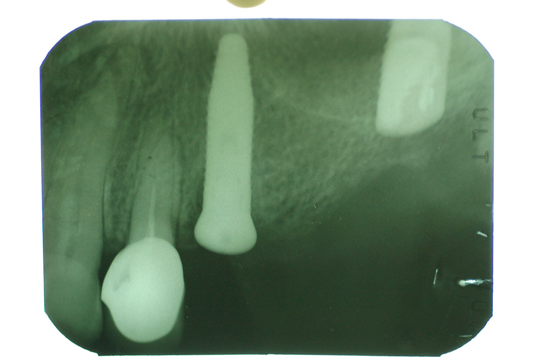 %_tempFileNameImplant%2015a7%