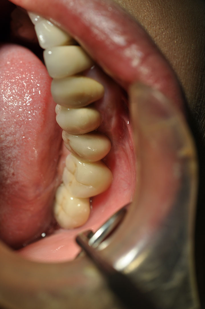 %_tempFileNameImplant%2017c3%