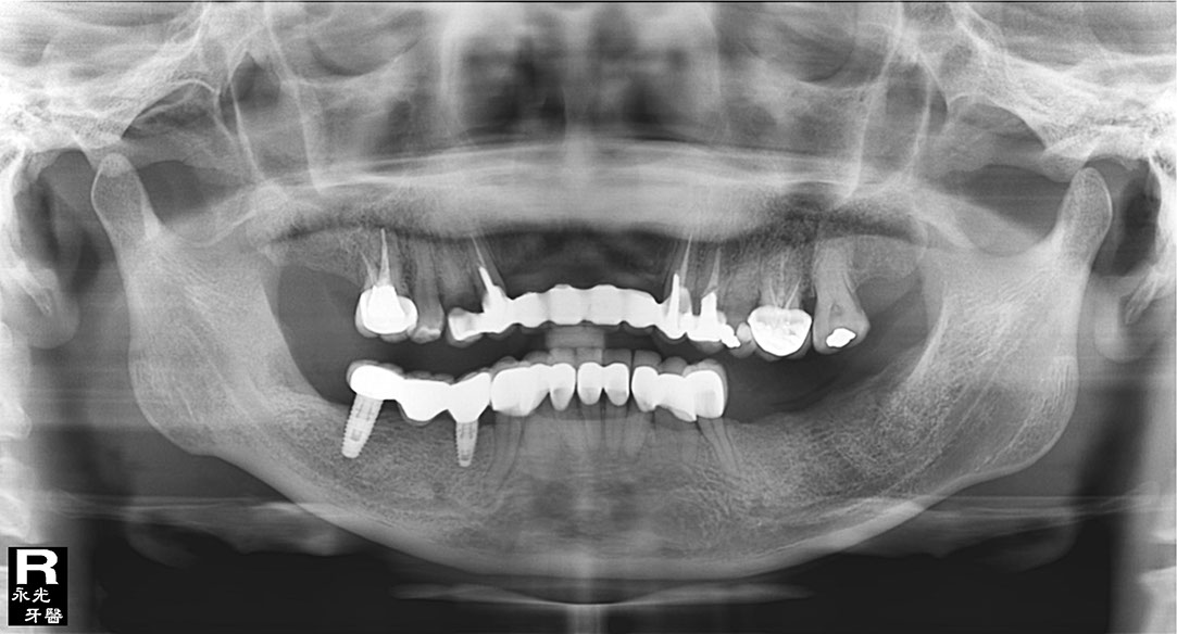 %_tempFileNameImplant%2017d2%