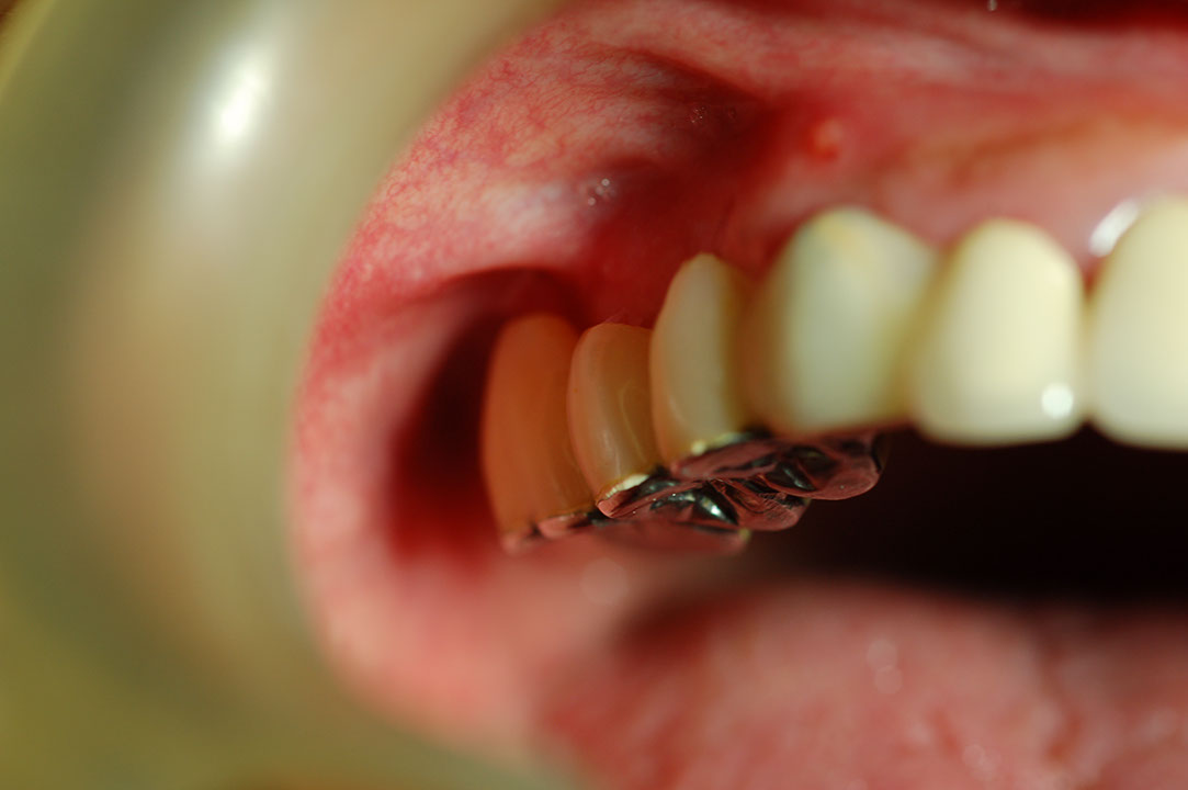 %_tempFileNameImplant%2018a%
