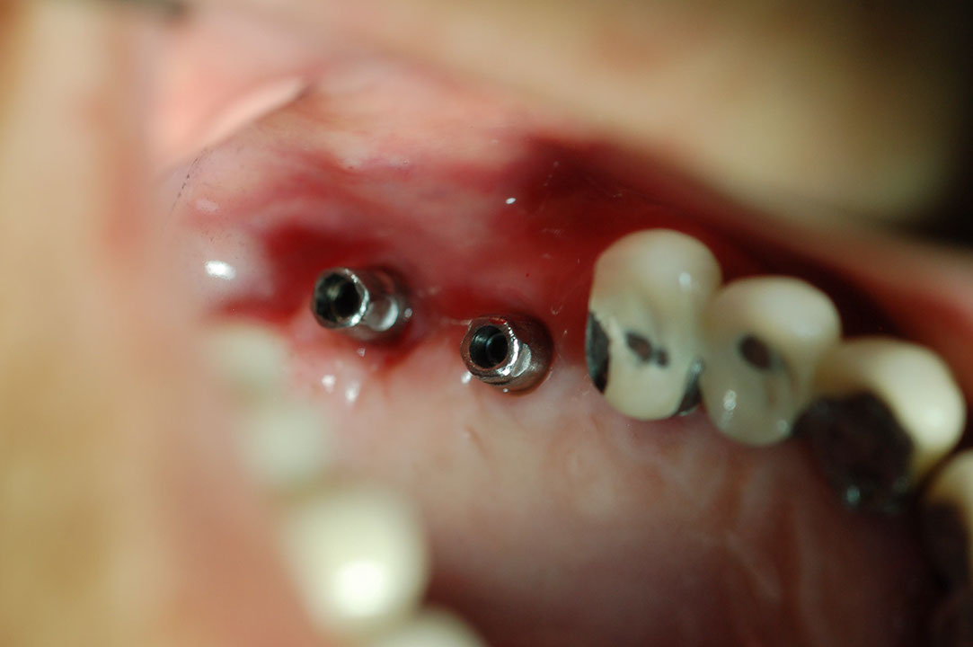 %_tempFileNameImplant%2024a2%
