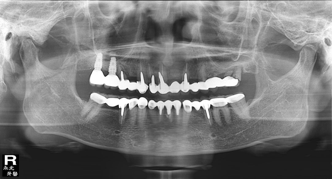 %_tempFileNameImplant%2024e5%