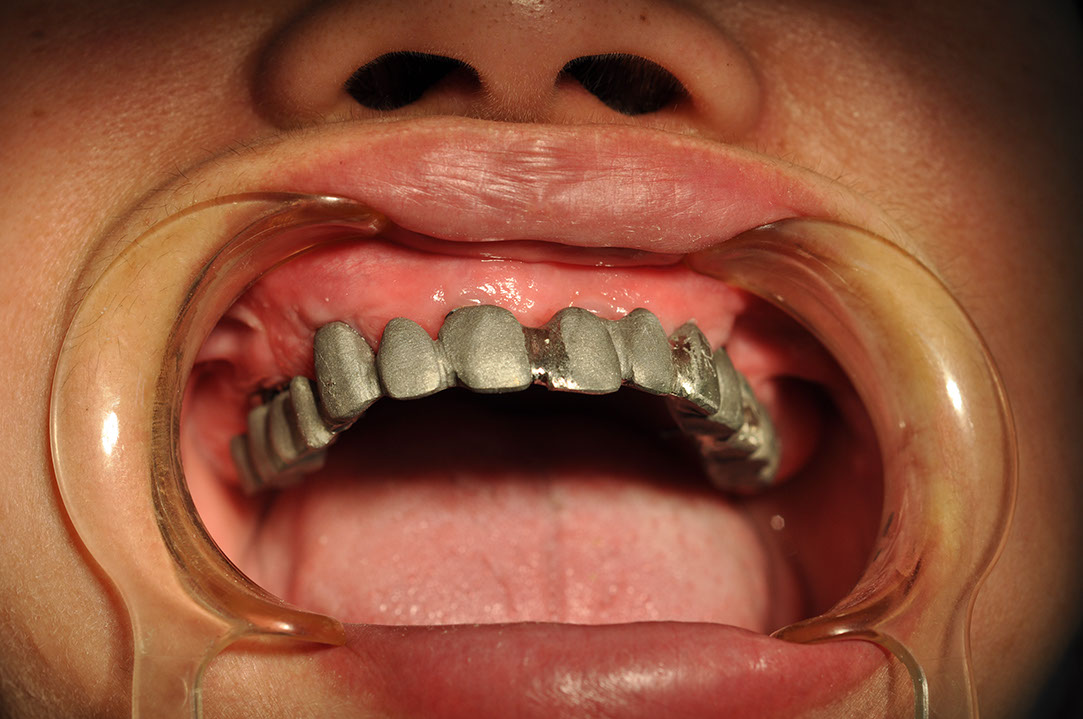 %_tempFileNameImplant%2026b6%