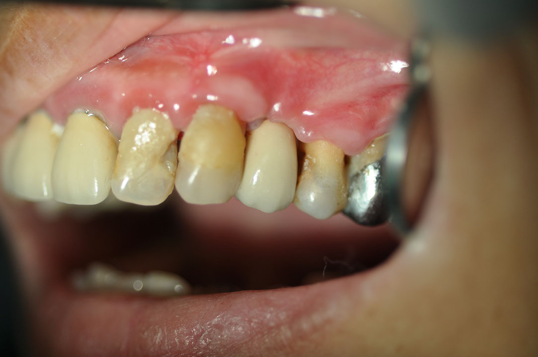 %_tempFileNameImplant%2028c1%